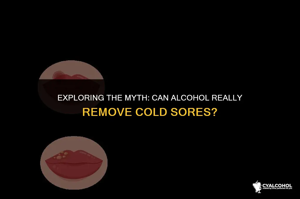 does alcohol remove cold sores