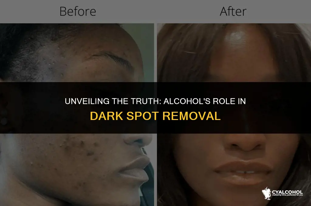 does alcohol remove dark spots