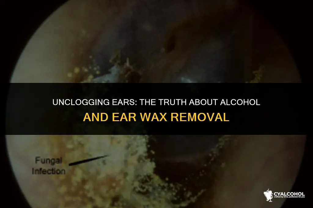 does alcohol remove ear wax