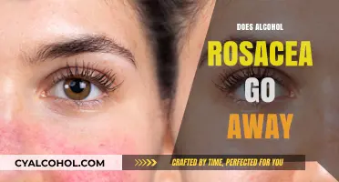 Understanding Alcohol-Induced Rosacea: Can It Be Reversed?