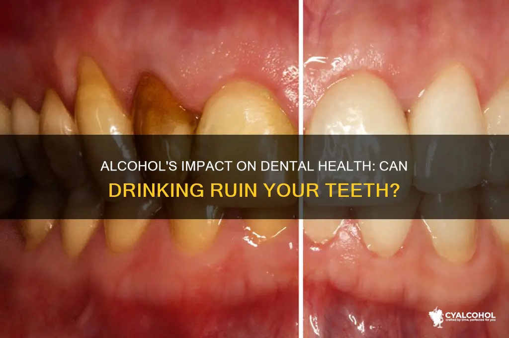 does alcohol ruin teeth