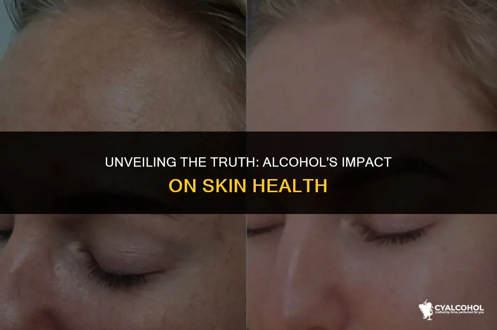 does alcohol scar your skin