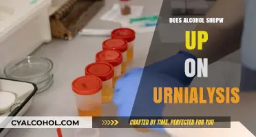 Does Alcohol Show Up on Urinalysis? Facts and Detection Timeline