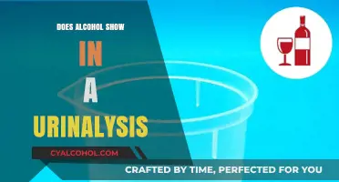 Does Alcohol Appear in Urine Tests? Understanding Urinalysis Detection