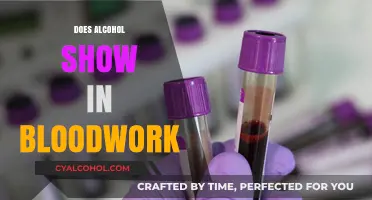 Unveiling the Truth: Alcohol's Presence in Bloodwork Explained