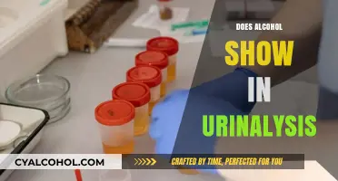Can Alcohol Be Detected in a Urinalysis Test?