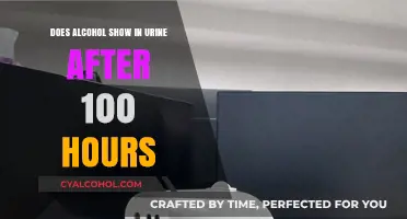 How Long Does Alcohol Stay Detectable in Urine After 100 Hours?