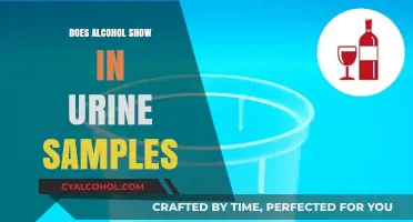 Does Alcohol Show in Urine Samples? Detection Window Explained