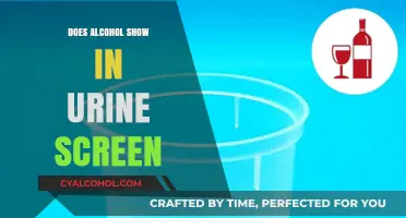 Does Alcohol Show in Urine Tests? Facts and Detection Time Explained