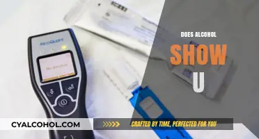 Does Alcohol Show Up? Understanding Detection Methods and Timeframes