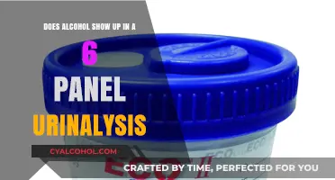 Urinalysis and Alcohol: What Does the Test Reveal?