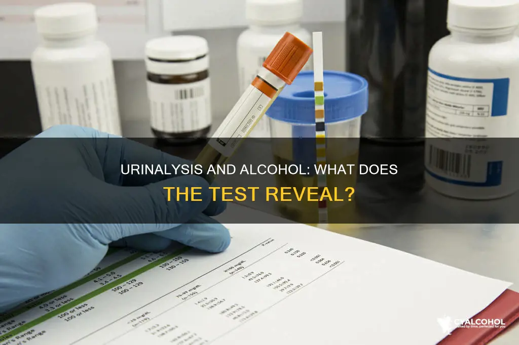 does alcohol show up in a 6 panel urinalysis