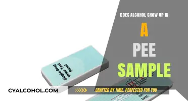 Does Alcohol Appear in Urine Tests? Facts and Detection Timeframe