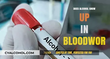 Does Alcohol Appear in Blood Tests? Understanding Detection in Bloodwork
