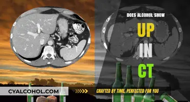 Does Alcohol Appear in CT Scans? Uncovering the Truth and Facts