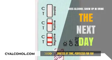 Urine Test for Alcohol: Does it Show Up the Next Day?