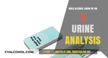 Does Alcohol Appear in Urine Tests? Facts and Detection Timeframe