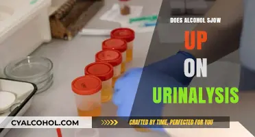 Does Alcohol Show Up on Urinalysis? Facts and Detection Timeline