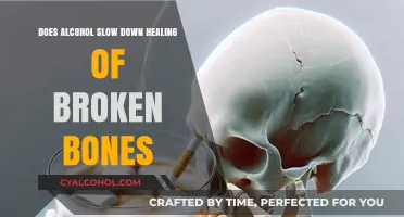 Alcohol's Impact: Does Drinking Delay Broken Bone Healing?