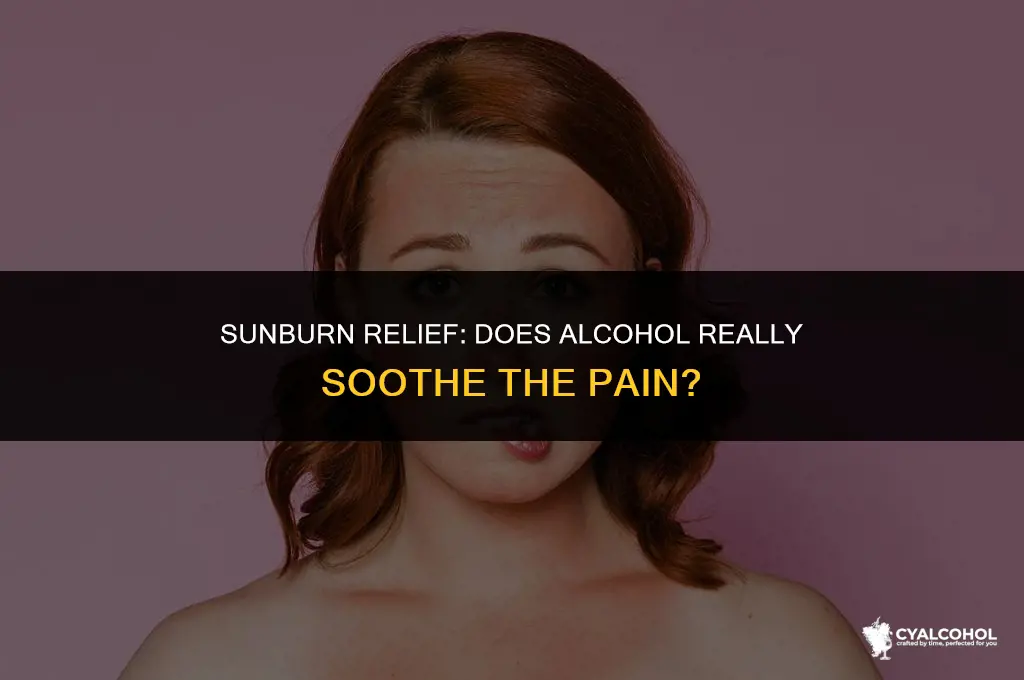 does alcohol soothe a sunburn