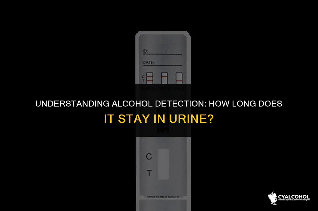 does alcohol stay in pee