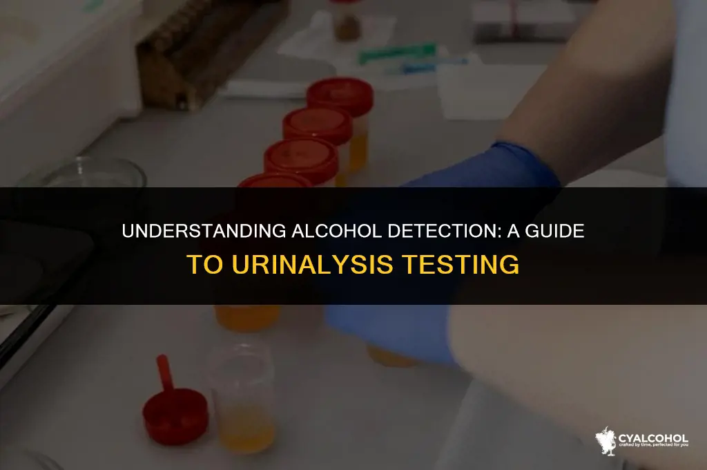 does alcohol stay in urinalysis