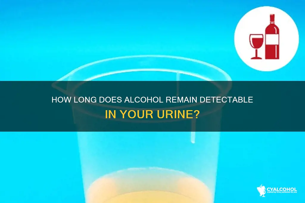 does alcohol stay in your urine