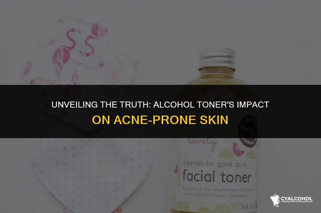 does alcohol toner irritate acne