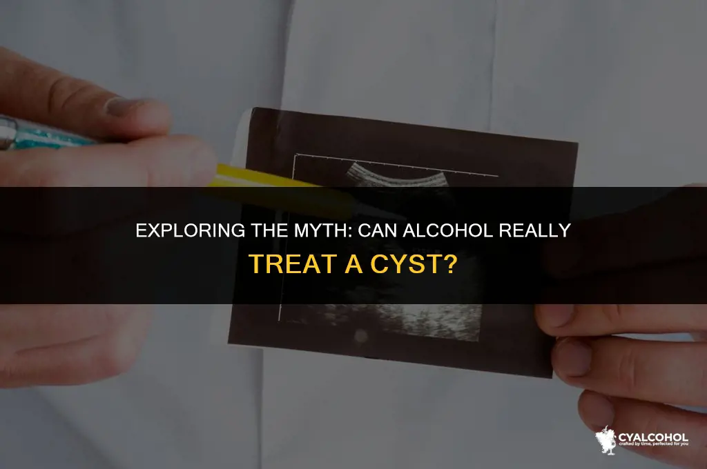 does alcohol treat a cist