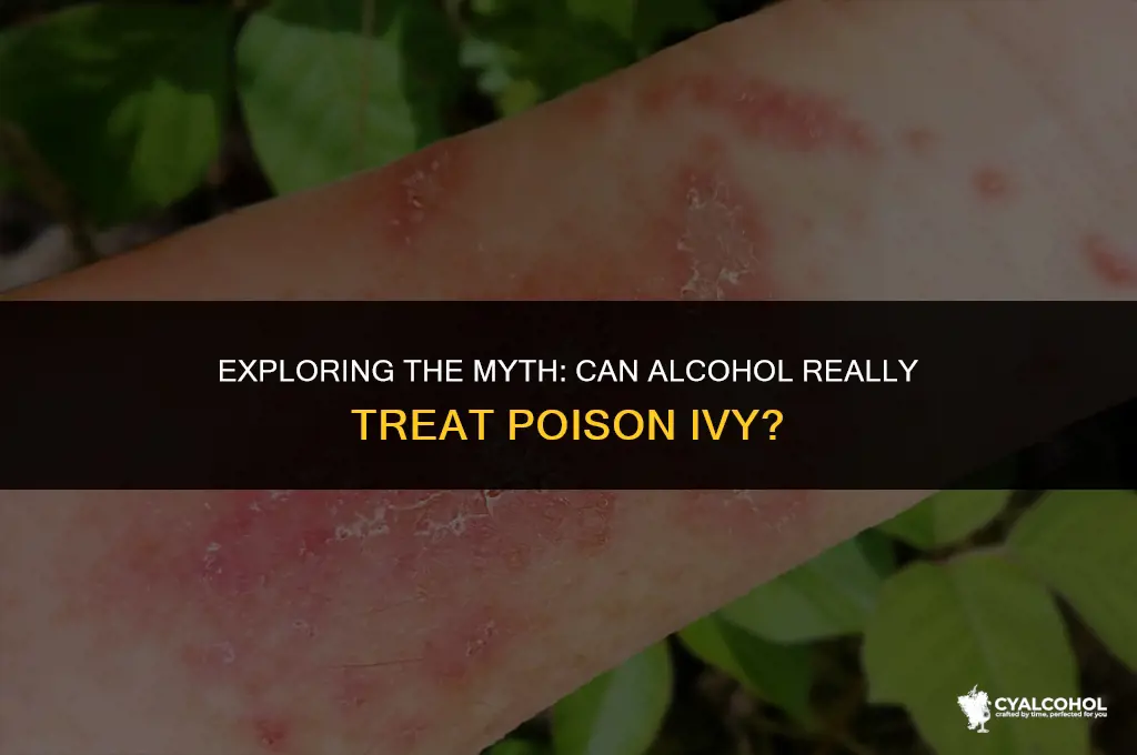 does alcohol treat poison ivy