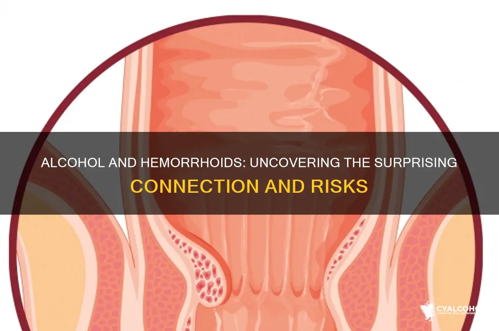 does alcohol trigger hemorrhoids
