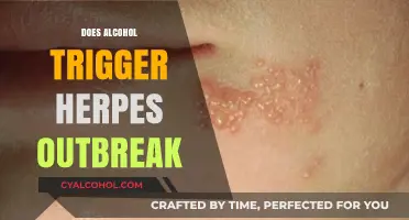 Unveiling the Truth: Alcohol's Impact on Herpes Outbreaks