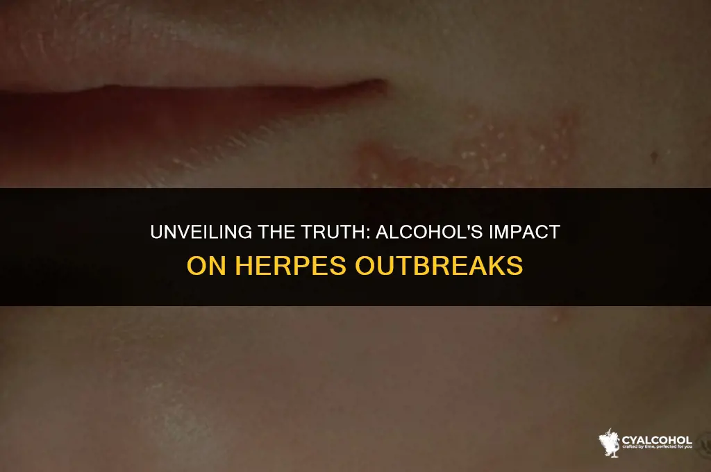 does alcohol trigger herpes outbreak