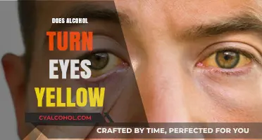 The Truth About Alcohol's Effects on Your Eyes: Yellowing and Beyond