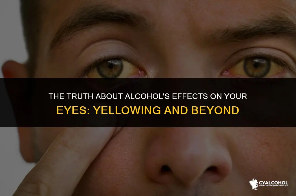 does alcohol turn eyes yellow
