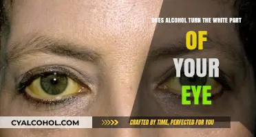 How Alcohol Turns Your Eyes White