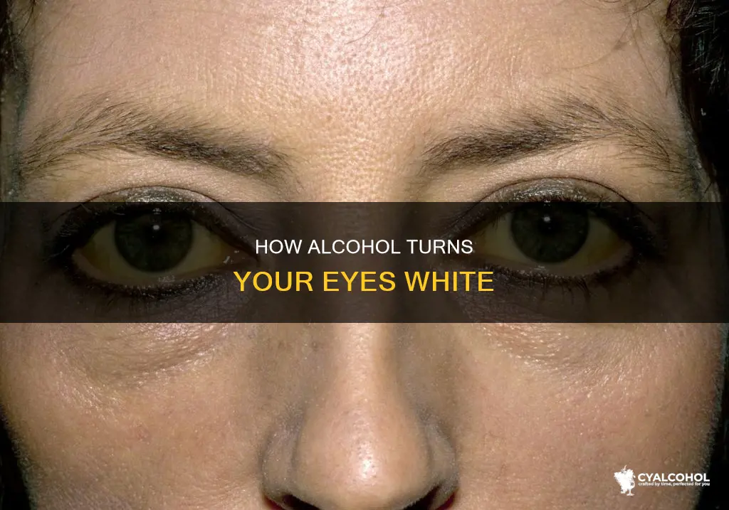 does alcohol turn the white part of your eye