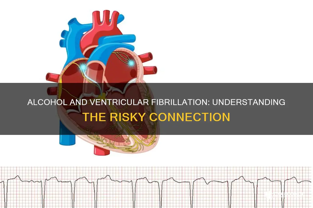 does alcohol ventricular fibrillation