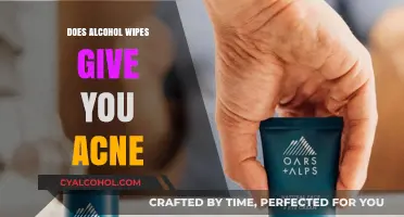 Can Alcohol Wipes Cause Acne? Uncovering the Truth Behind Skin Irritation