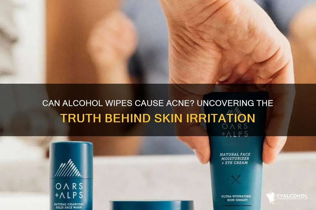 does alcohol wipes give you acne
