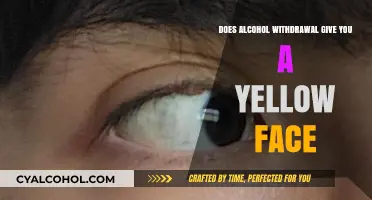 Alcohol Withdrawal and Skin Discoloration: Can It Cause a Yellow Face?