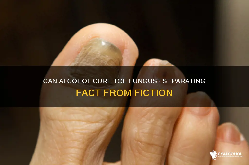 does alcohol work for toe fungus
