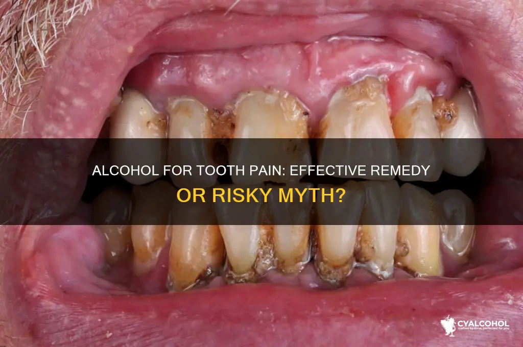 does alcohol work for tooth pain