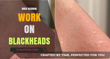 Unclogging Pores: The Truth About Alcohol and Blackheads