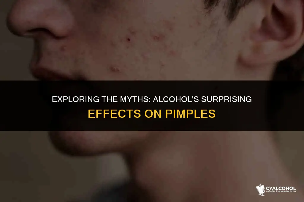 does alcohol work on pimples