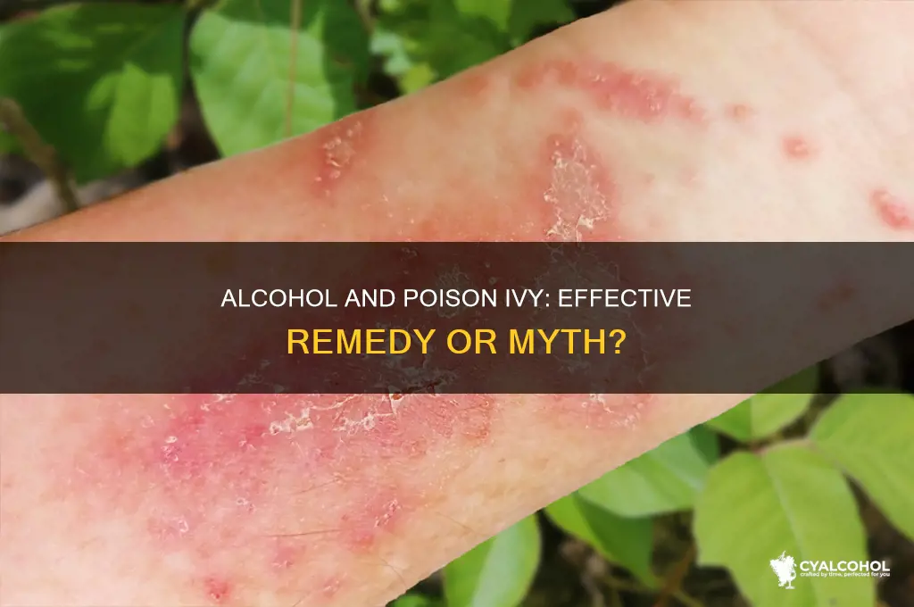 does alcohol work on poison ivy