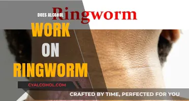 Exploring the Myths: Does Alcohol Really Treat Ringworm?