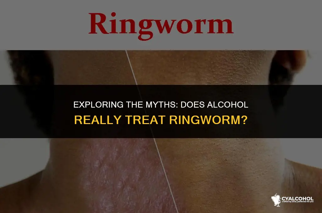 does alcohol work on ringworm