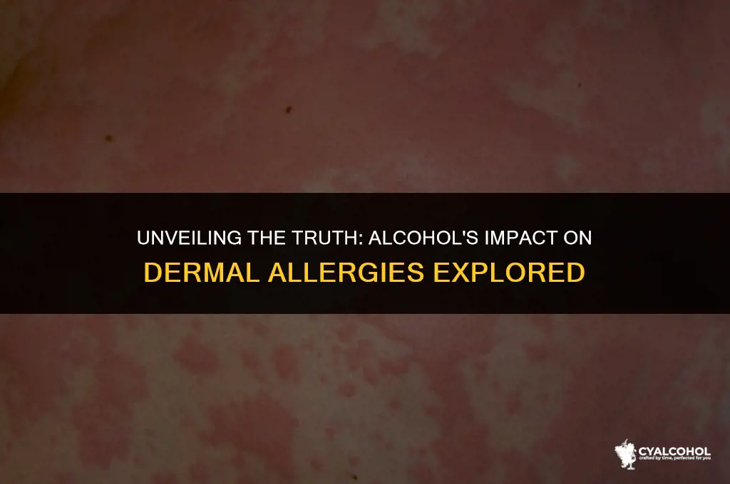 does alcohol worsen dermal allergy