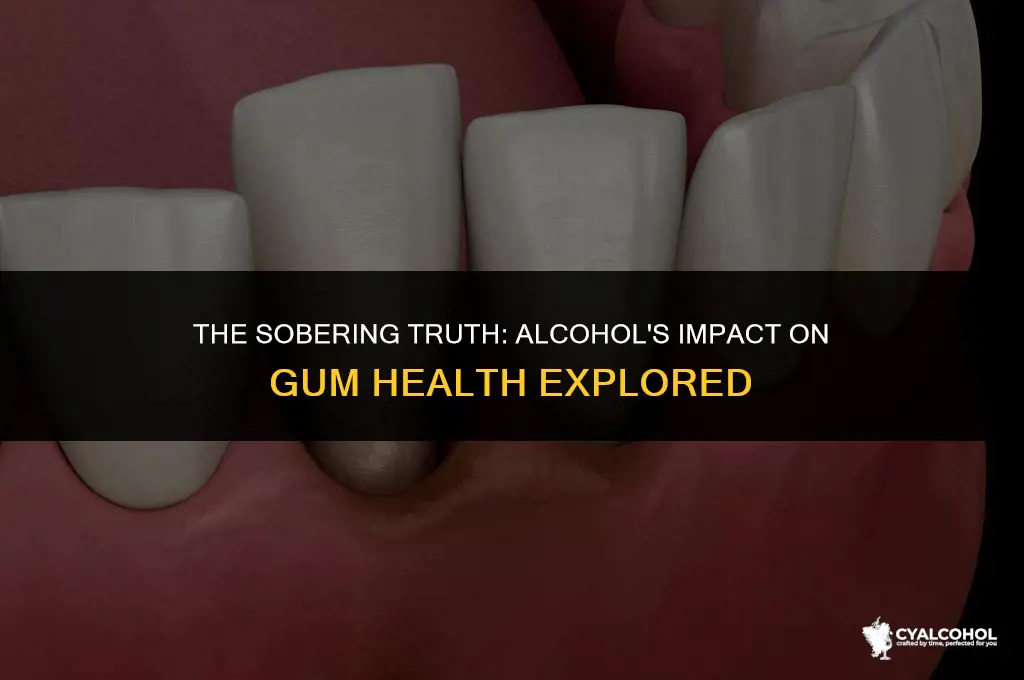 does alcohol worsen gum disease